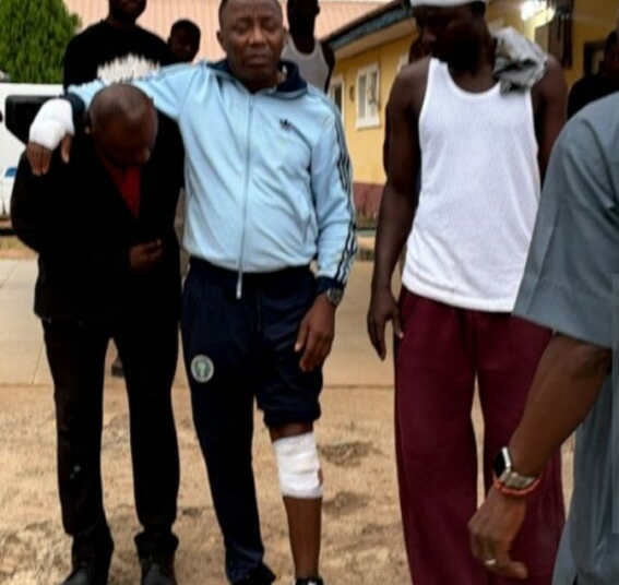 Sowore Seeks International Sanctions Against Oyebanji, Ikogosi Marathon Organisers Over Alleged Attack 1 Screenshot 20261031 144039 1
