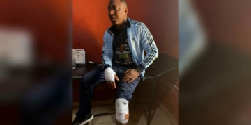 Sowore Accuses Police In Ekiti Cover-Up Over Attack 1 Sowore Accuses Police In Ekiti Cover-Up Over Attack