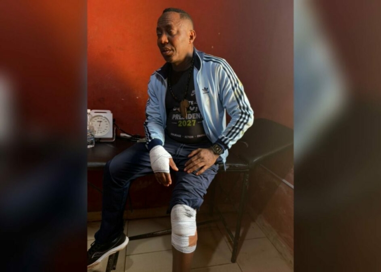 Sowore Accuses Police In Ekiti Cover-Up Over Attack 1 Sowore injured in Ekiti altercation