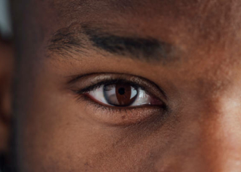 Plateau To Offer Free Cataract Surgeries To 100 Patients