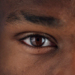 Plateau To Offer Free Cataract Surgeries To 100 Patients 4 Plateau To Offer Free Cataract Surgeries To 100 Patients