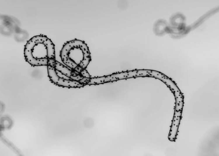 Deadly Bundibugyo Ebola Strain Confirmed in Nigeria: What You Need to Know
