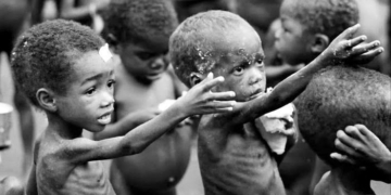 Nigeria, US Organisation To Tackle Child Malnutrition 2 Nigeria, US Organisation To Tackle Child Malnutrition